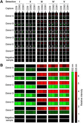 Photometric method for dual targeting of surface and surface-associated proteins on extracellular vesicles in the multiparametric test